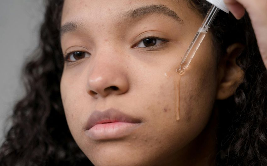 La Niacinamide si può usare in estate?